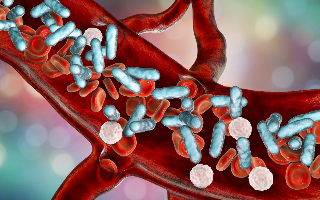 New Protocols Lower Sepsis Rates